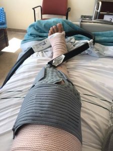Post-surgery knee